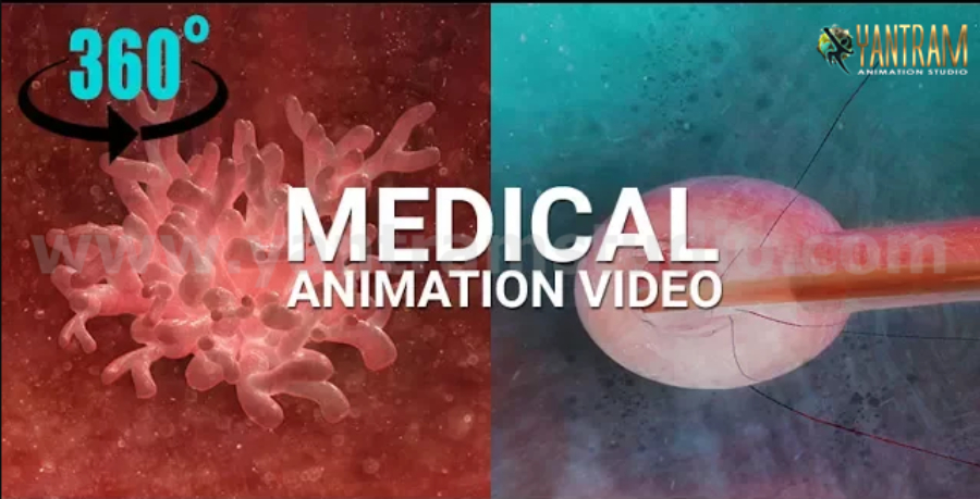 360° Panoramic interactive virtual tours of 3D Medical Animation by Virtual Reality Studio – Columbus, Ohio